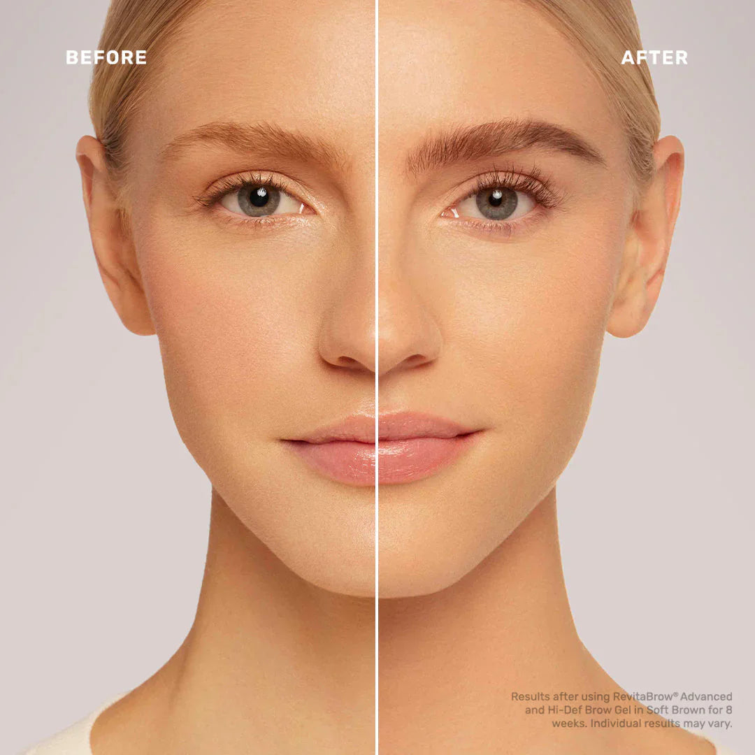 6 przyczyn przerzedzonych brwi