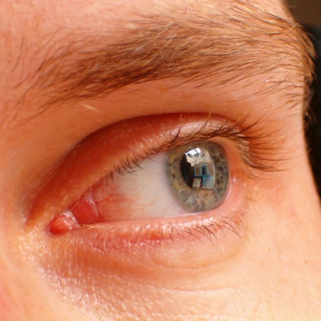 Czy odżywki do rzęs i brwi mogą wspomóc osoby z przerzedzonymi włoskami?